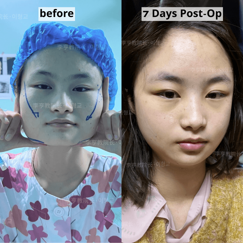 Case 1 - Photo 1