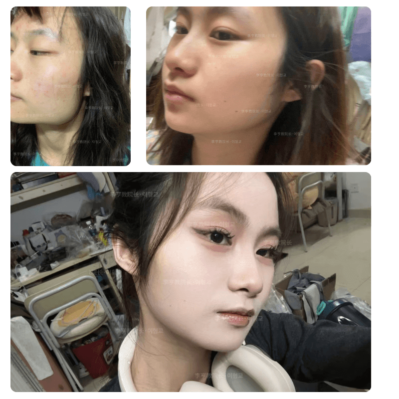 Case 1 - Photo 3