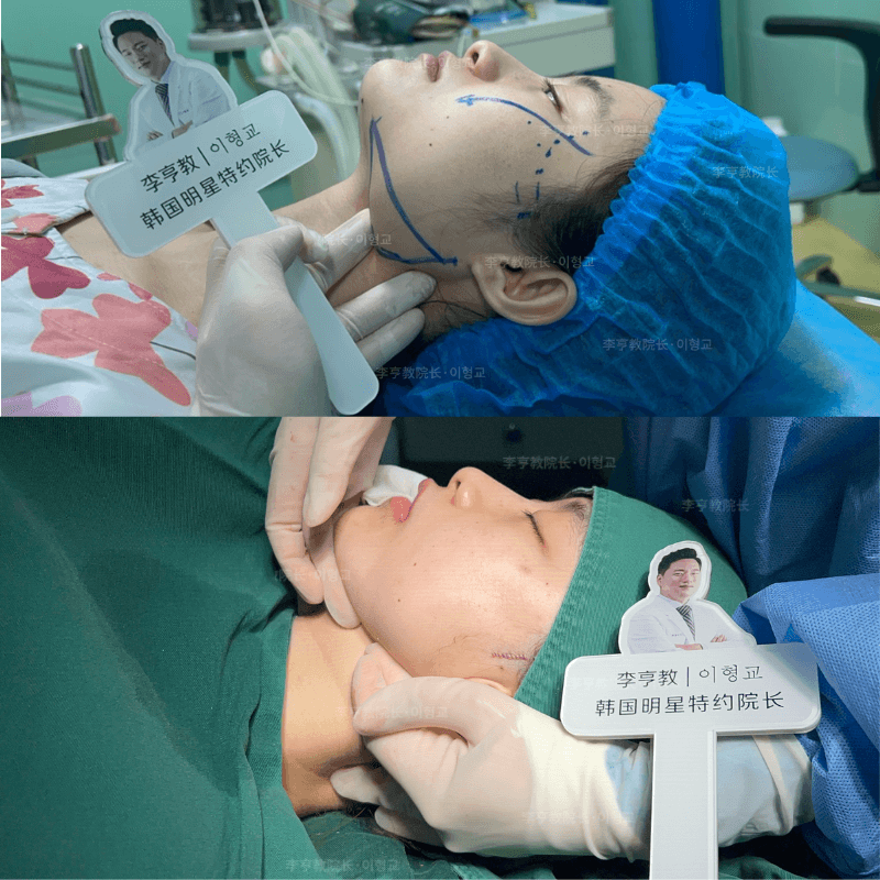 Case 1 - Photo 4