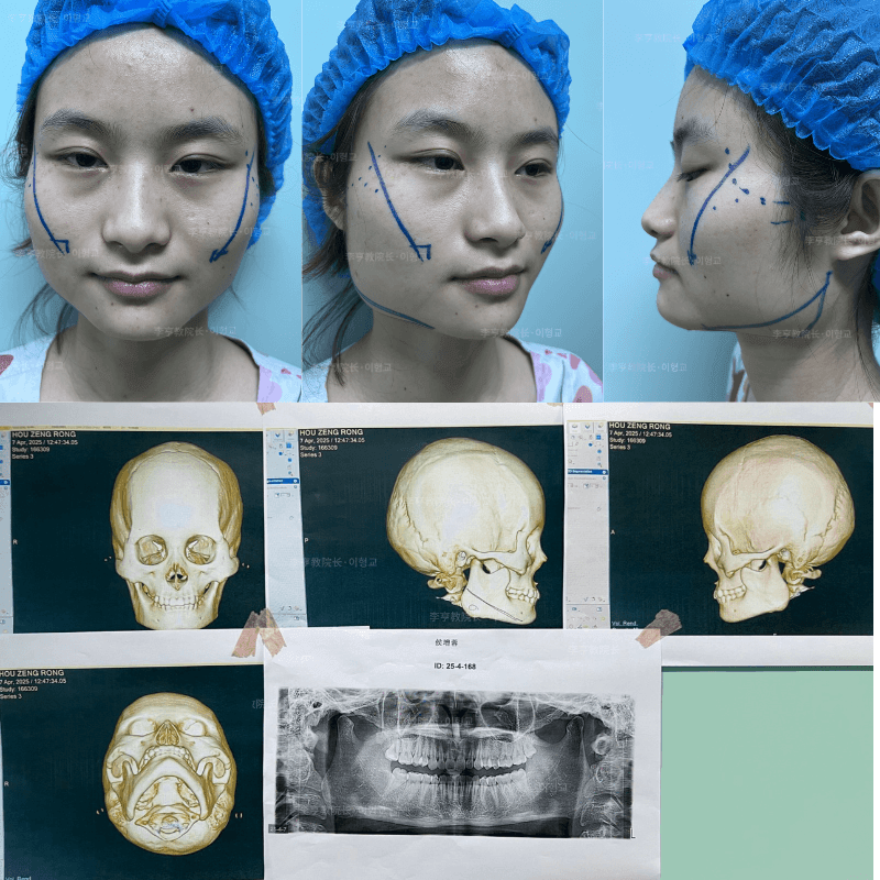 Case 1 - Photo 6