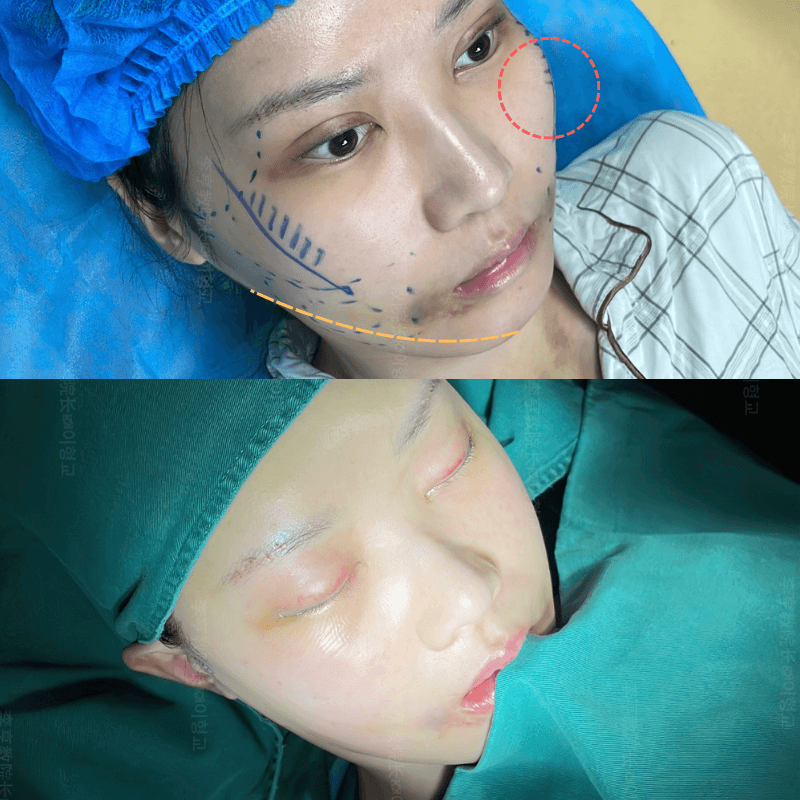 Case 2 - Photo 3