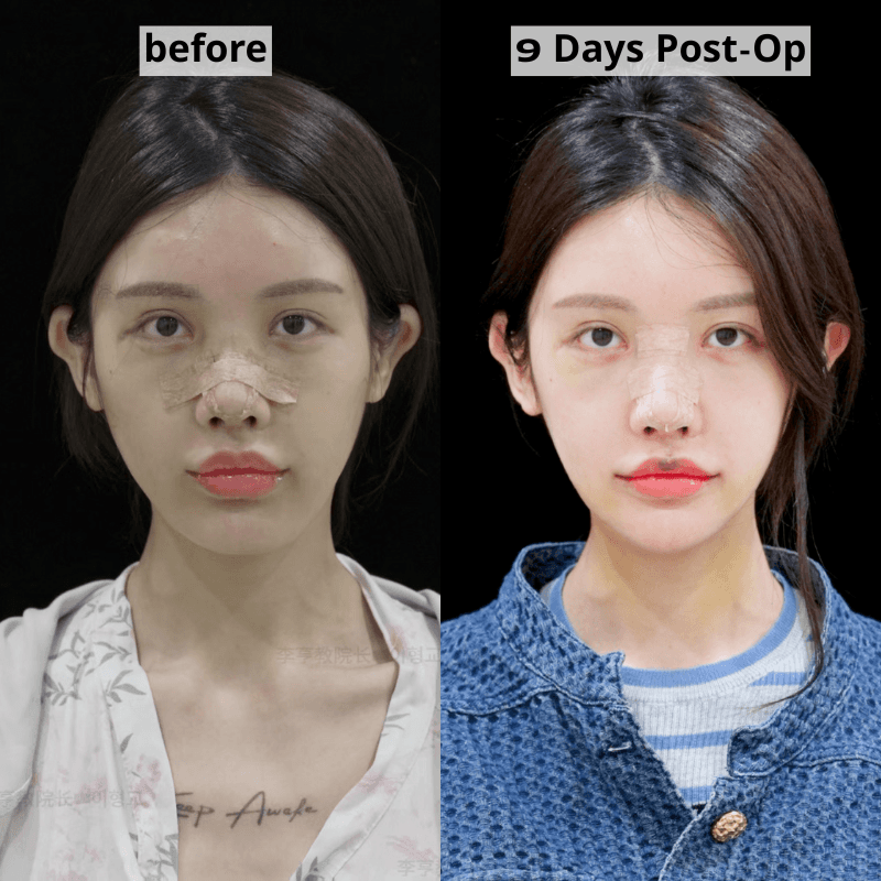 Case 3 - Photo 1