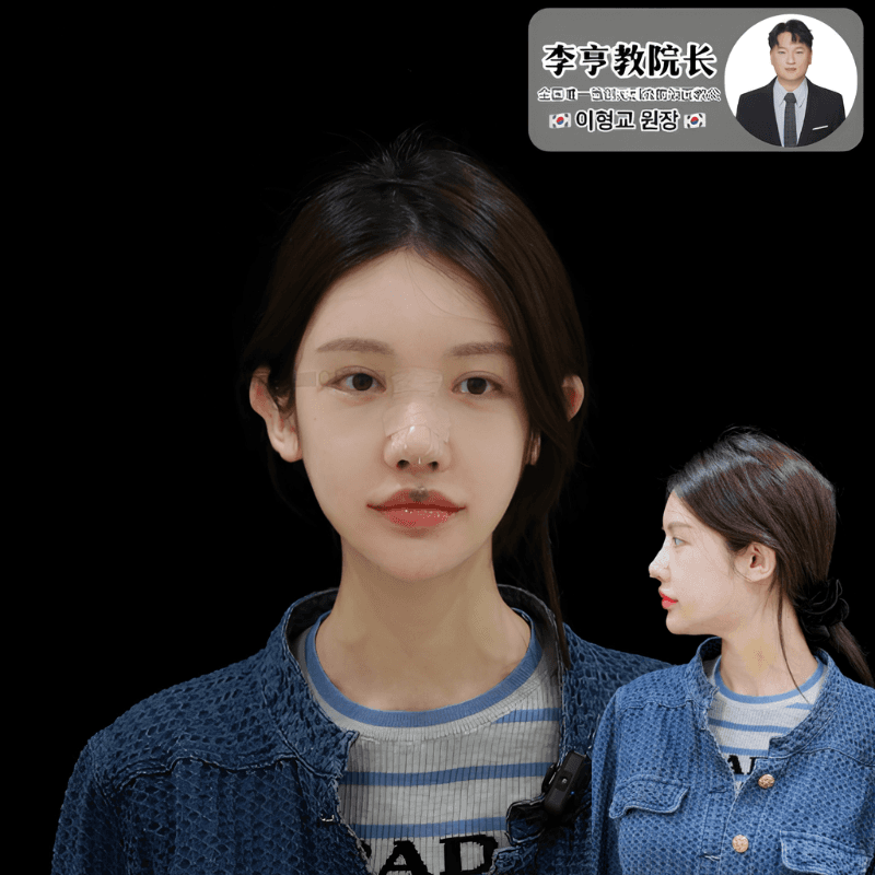 Case 3 - Photo 3