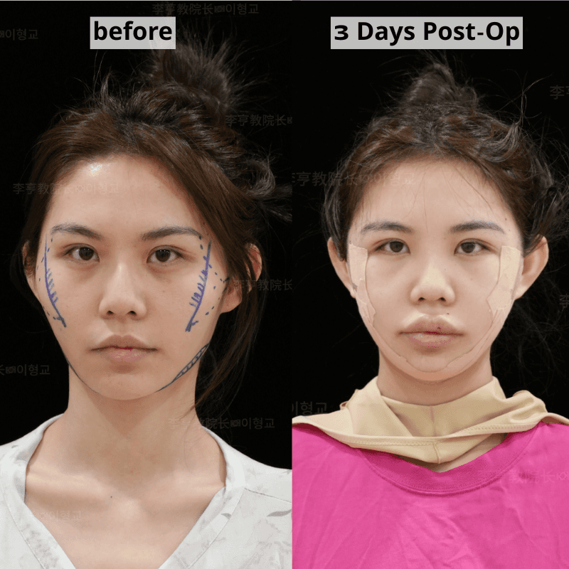 Case 4 - Photo 1