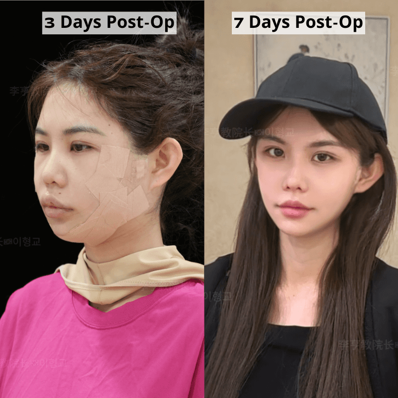 Case 4 - Photo 2