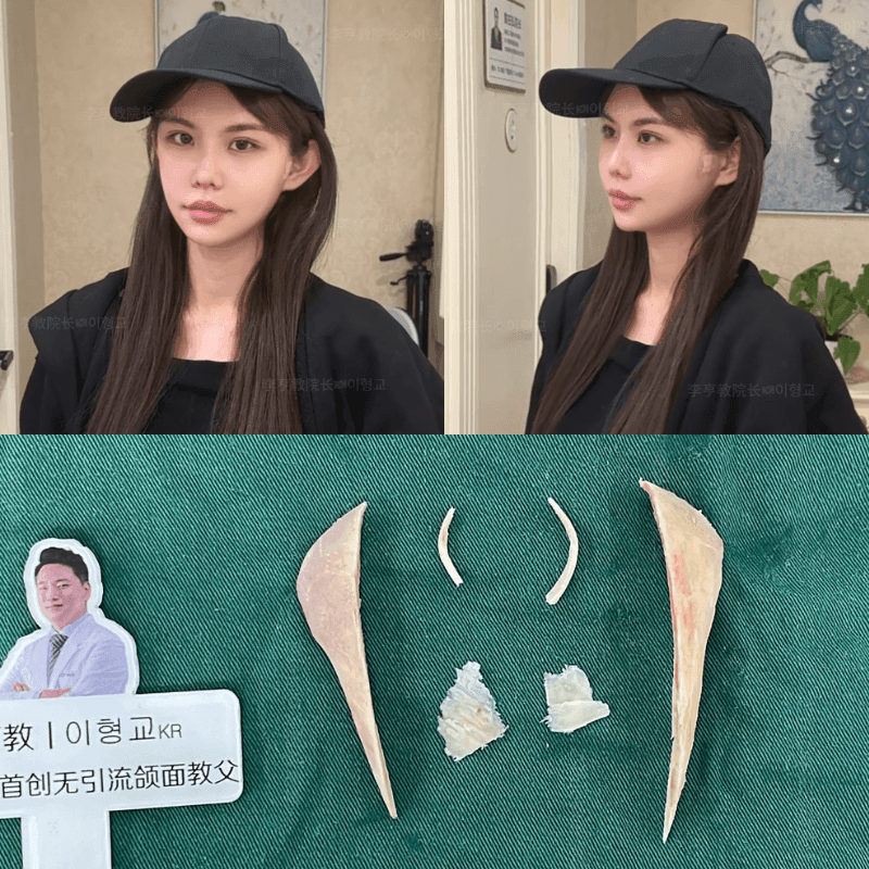Case 4 - Photo 5