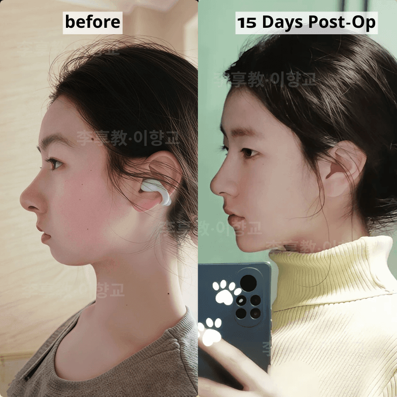 Case 6 - Photo 1
